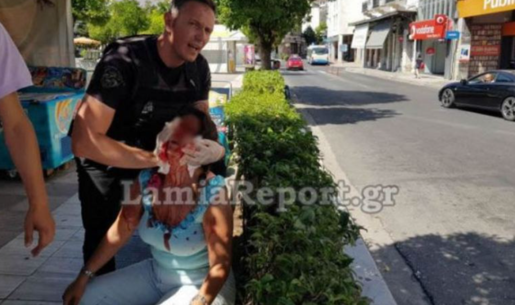 Σκληρό βίντεο: Γυναίκα στη Λαμία ξυλοκοπήθηκε από τον πρώην της μέσα στη μέση του δρόμου