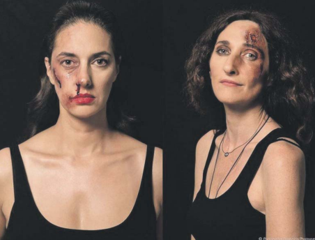 25 Νοεμβρίου: Διεθνής Ημέρα για την Εξάλειψη της Βίας κατά των Γυναικών