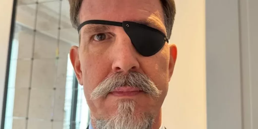 Ο Παύλος αποκάλυψε γιατί έχει κάλυμμα στο μάτι -Η επώδυνη επέμβαση