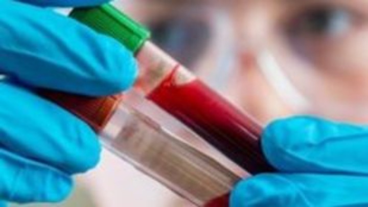 Oι καρκίνοι του αίματος αντιπροσωπεύουν σχεδόν το 10% όλων των νέων διαγνώσεων καρκίνου κάθε χρόνο