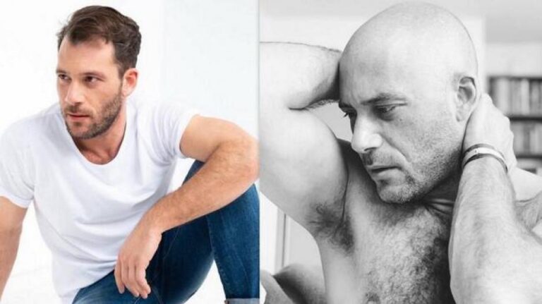 Αλμπάνης: Ξέρεις τι είναι να σου έχουν πέσει τα μαλλιά και να σου λένε ότι είσαι χάλια; (video)