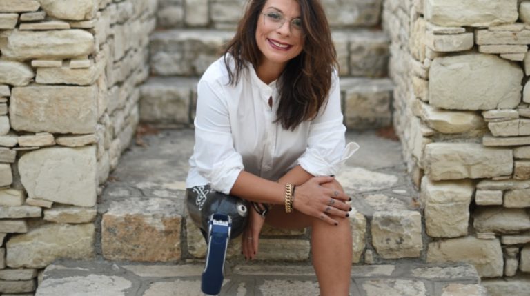 Οι πληγές που άφησε το άγριο bullying στην Πένυ Σκάρου (video)