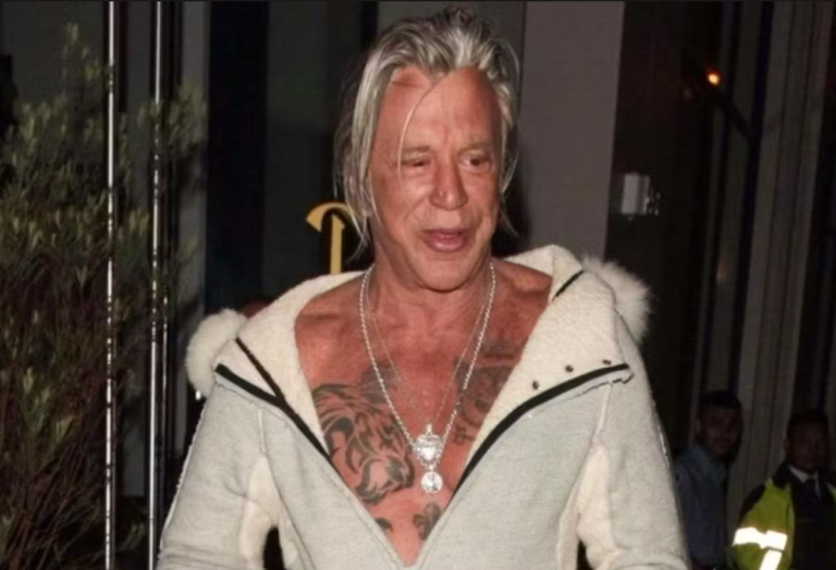 Παραμορφωμένος και αγνώριστος ο Μίκι Ρουρκ από τις πλαστικές επεμβάσεις (photo)