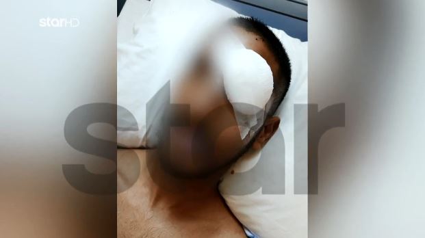 Έχασε το μάτι του από σκάγια 18χρονου που πυροβολούσε στα τυφλά! (PHOTO)