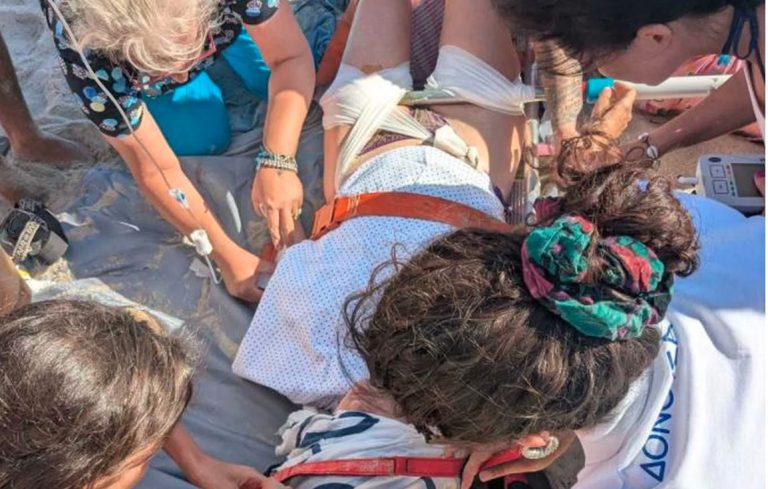 Σώθηκε από τύχη στη Δονούσα: Κοντάρι ομπρέλας καρφώθηκε στο πόδι νεαρής! (photo)