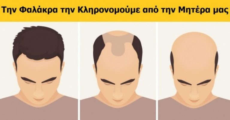 Εσείς τα ξέρετε; 10 Παράξενα χαρακτηριστικά που κληρονομούμε από τους γονείς μας